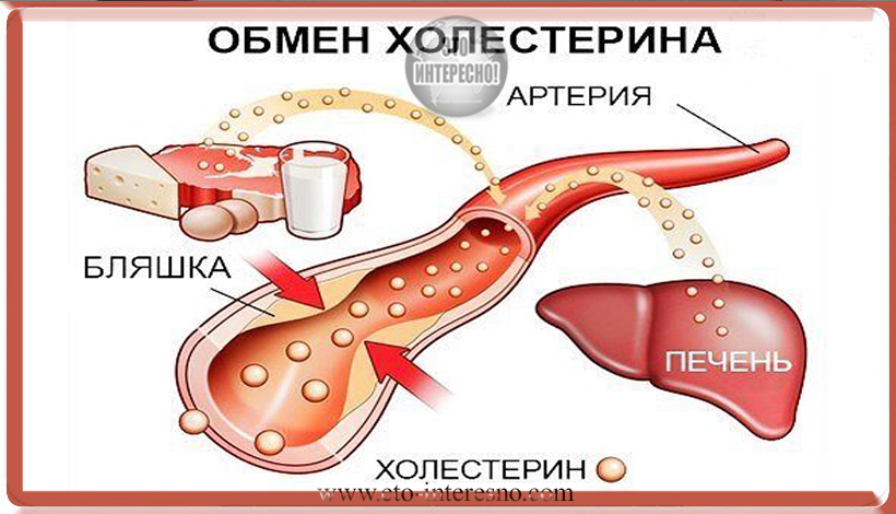 СНИЖАЕМ УРОВЕНЬ ХОЛЕСТЕРИНА. ЭТО КАСАЕТСЯ КАЖДОГО!