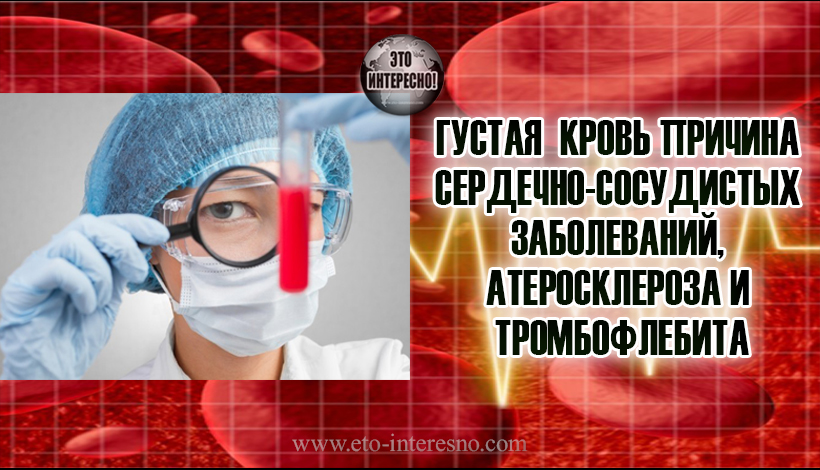 ГУСТАЯ  КРОВЬ КАК ПРИЧИНА СЕРДЕЧНО-СОСУДИСТЫХ ЗАБОЛЕВАНИЙ, АТЕРОСКЛЕРОЗА И ТРОМБОФЛЕБИТА