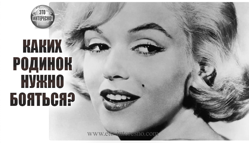 КАКИХ РОДИНОК НУЖНО БОЯТЬСЯ?А ВЫ ЗНАЛИ ОБ ЭТОМ?