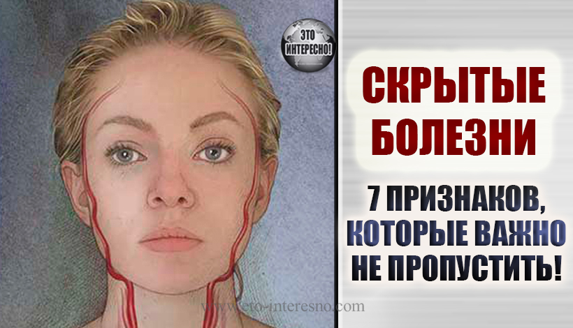 СКРЫТЫЕ БОЛЕЗНИ: 7 ПРИЗНАКОВ, КОТОРЫЕ ВАЖНО НЕ ПРОПУСТИТЬ!