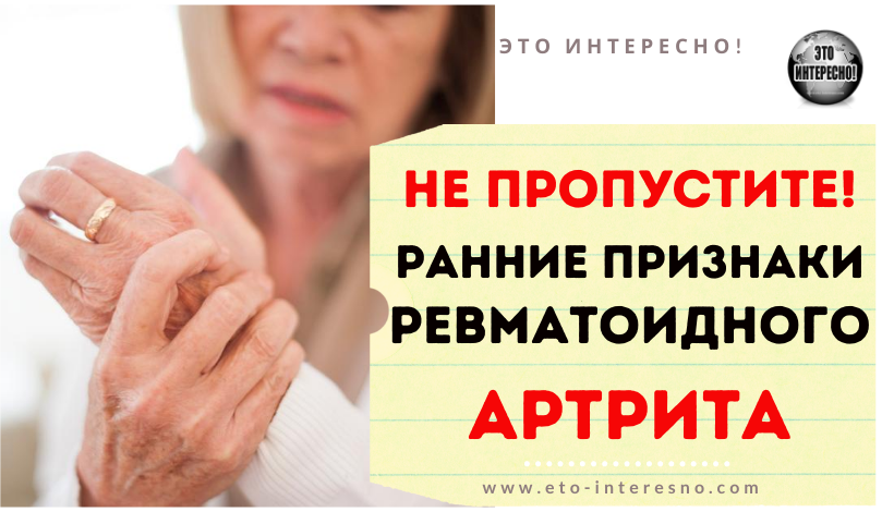 НЕ ПРОПУСТИТЕ! РАННИЕ ПРИЗНАКИ И СИМПТОМЫ РЕВМАТОИДНОГО АРТРИТА