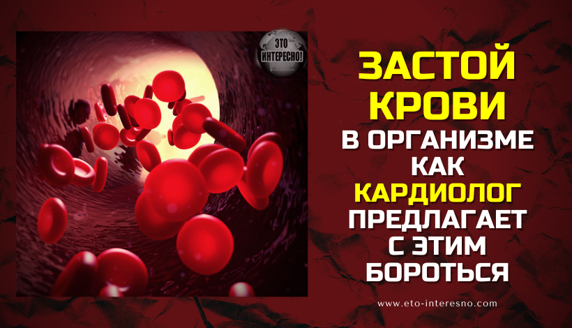 ЗАСТОЙ КРОВИ В ОРГАНИЗМЕ - КАК КАРДИОЛОГ ПРЕДЛАГАЕТ С ЭТИМ БОРОТЬСЯ