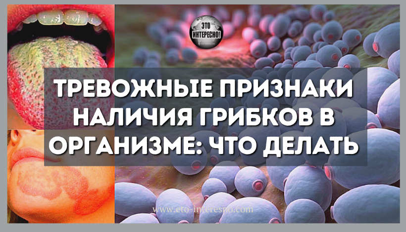 ТРЕВОЖНЫЕ ПРИЗНАКИ НАЛИЧИЯ ГРИБКОВ В ОРГАНИЗМЕ: ЧТО ДЕЛАТЬ