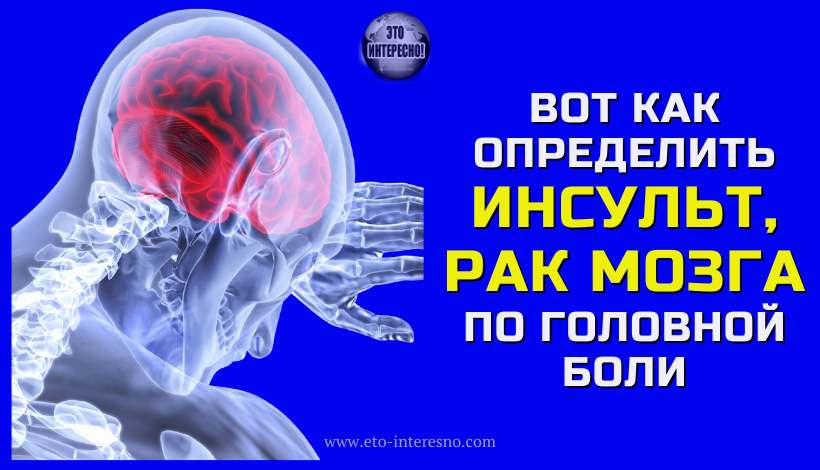 ВОТ КАК ОПРЕДЕЛИТЬ ИНСУЛЬТ, РАК МОЗГА И ДРУГИЕ БОЛЕЗНИ ПО ГОЛОВНОЙ БОЛИ